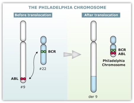philadelphia chromosome